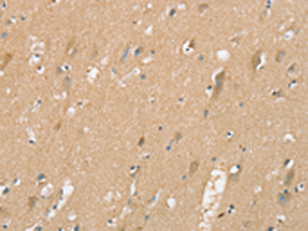 Rabbit Polyclonal Antibody to SIGLEC10