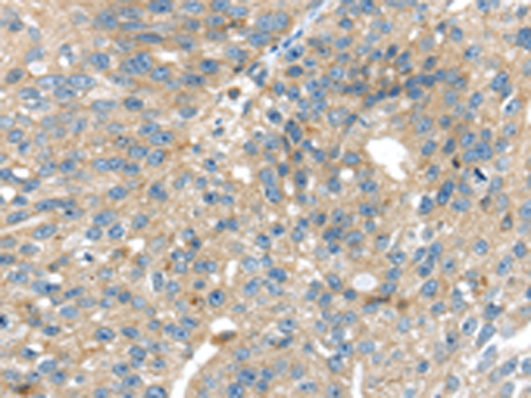 Rabbit Polyclonal Antibody to SIGLEC8