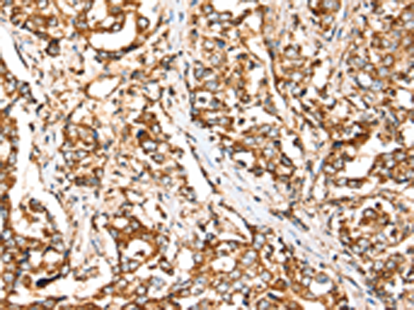 Rabbit Polyclonal Antibody to SIGLEC11