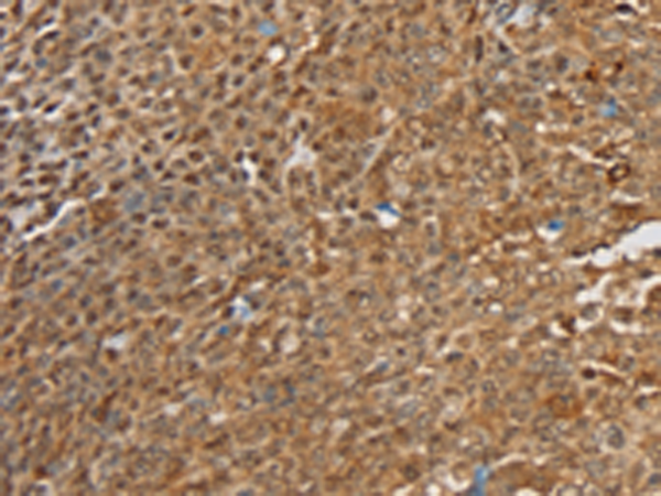 Rabbit Polyclonal Antibody to SIGLEC14