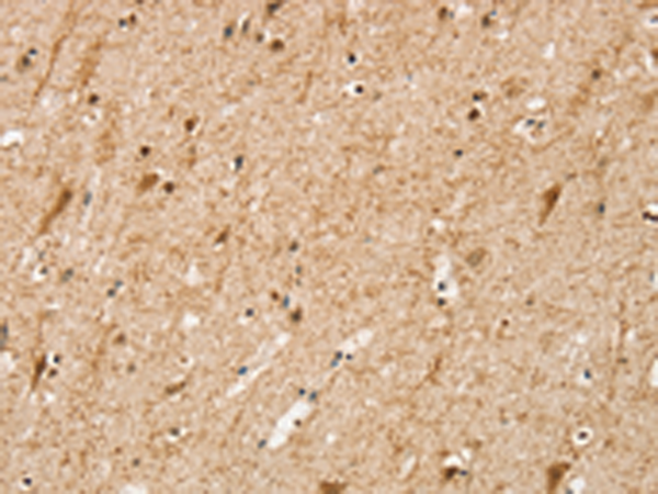 Rabbit Polyclonal Antibody to SRP68