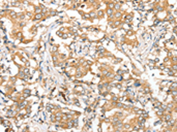 Rabbit Polyclonal Antibody to SIRT4