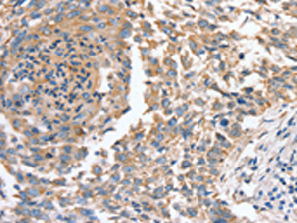Rabbit Polyclonal Antibody to SLC16A10