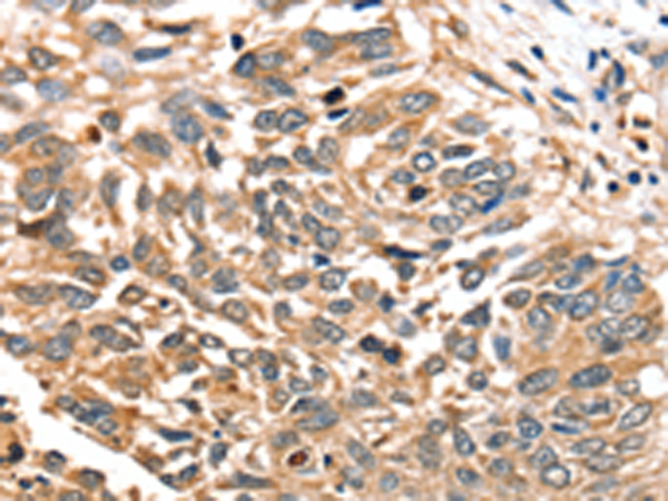 Rabbit Polyclonal Antibody to SLC16A12
