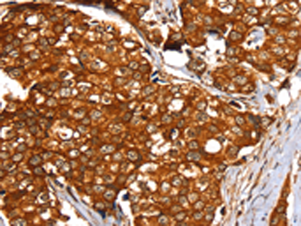 Rabbit Polyclonal Antibody to SLC24A3