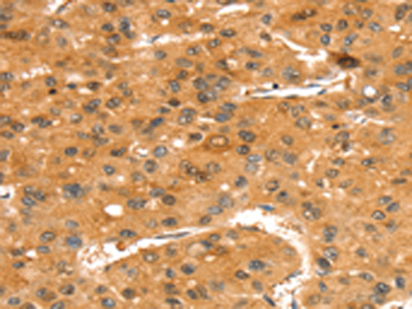 Rabbit Polyclonal Antibody to SLC24A4