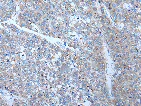 Rabbit Polyclonal Antibody to SLC24A5