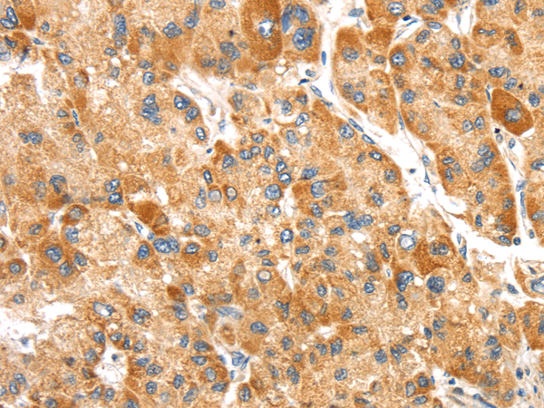 Rabbit Polyclonal Antibody to SLC8B1