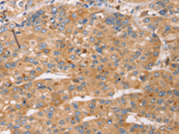 Rabbit Polyclonal Antibody to SLC25A38
