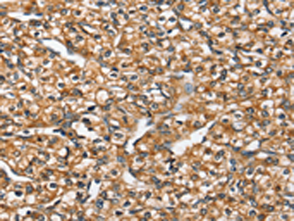 Rabbit Polyclonal Antibody to SLC26A5
