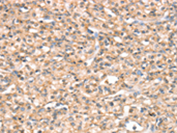Rabbit Polyclonal Antibody to SLC32A1