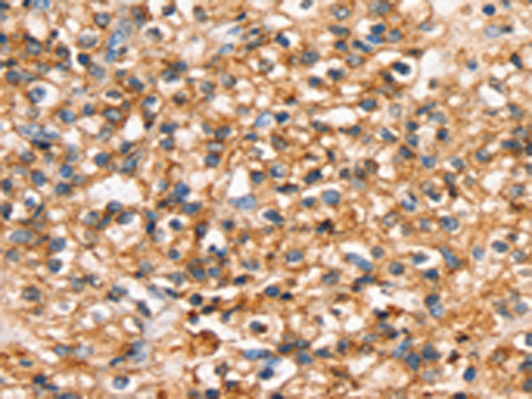 Rabbit Polyclonal Antibody to SLC34A3