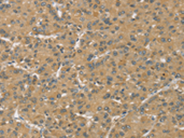 Rabbit Polyclonal Antibody to SLC39A3