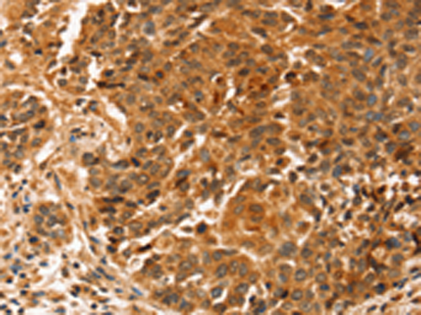Rabbit Polyclonal Antibody to SLC41A2