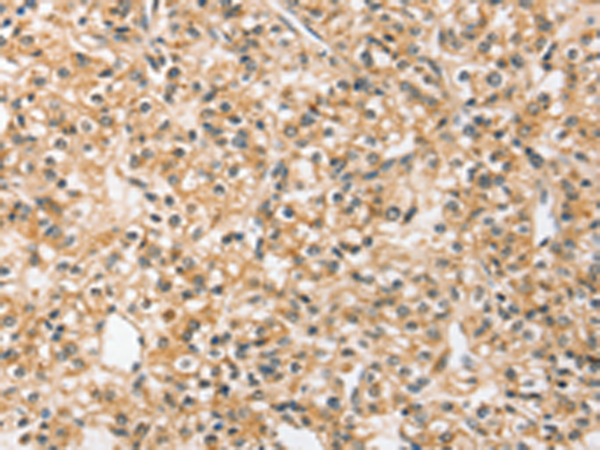 Rabbit Polyclonal Antibody to SLC44A2