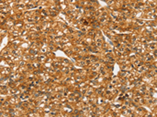 Rabbit Polyclonal Antibody to SLC4A7