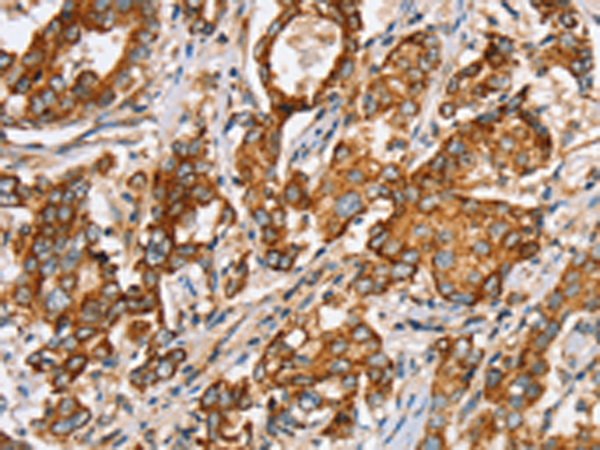 Rabbit Polyclonal Antibody to SLC5A11