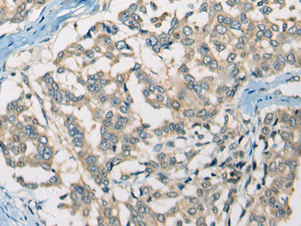 Rabbit Polyclonal Antibody to SLC5A3
