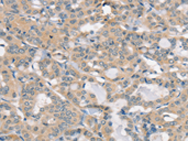 Rabbit Polyclonal Antibody to SLC6A8