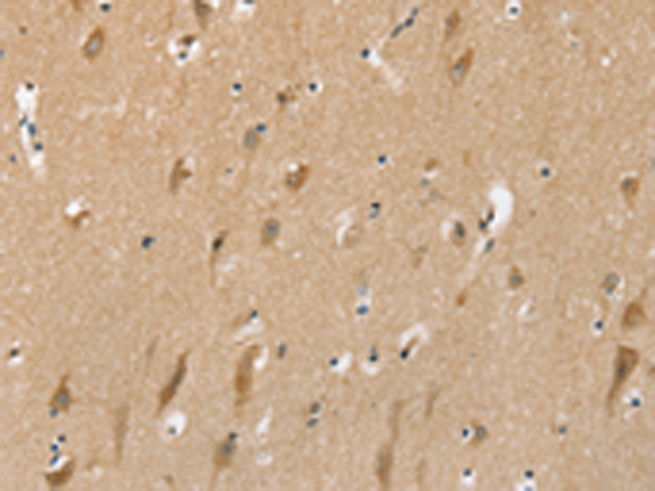 Rabbit Polyclonal Antibody to SLC6A7