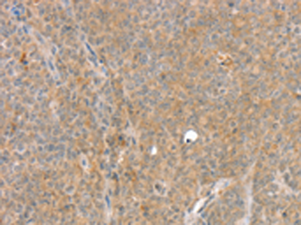Rabbit Polyclonal Antibody to SLC8A3
