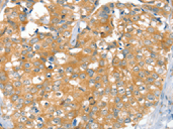 Rabbit Polyclonal Antibody to SLC9A9