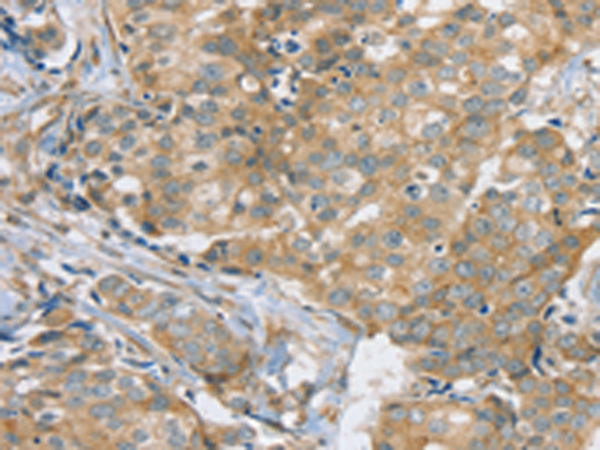 Rabbit Polyclonal Antibody to SLC9A3R2