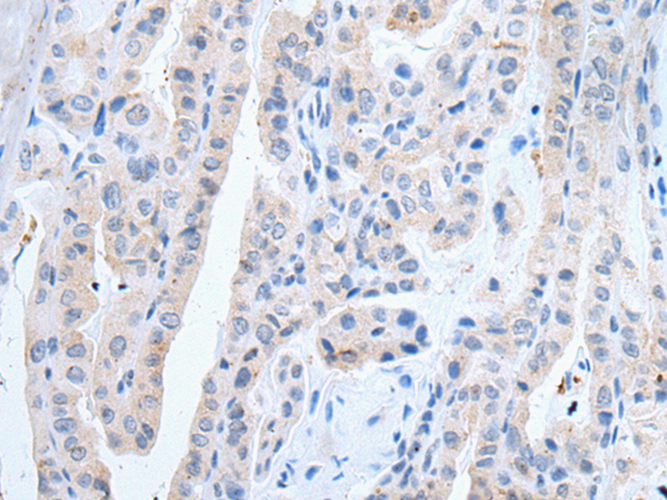 Rabbit Polyclonal Antibody to SLCO2B1