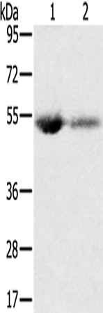 Rabbit Polyclonal Antibody to SLC13A3