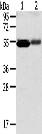 Rabbit Polyclonal Antibody to SLC17A1