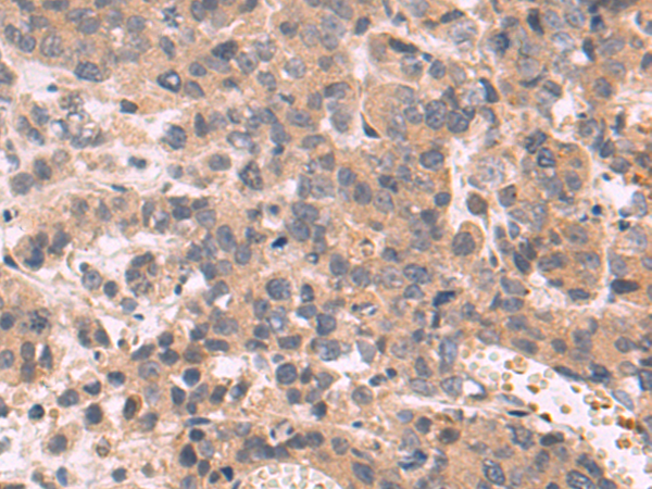 Rabbit Polyclonal Antibody to SLIT3