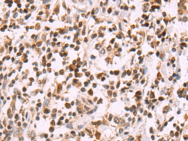 Rabbit Polyclonal Antibody to SLTM