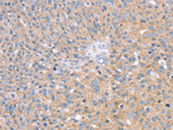 Rabbit Polyclonal Antibody to SMAGP