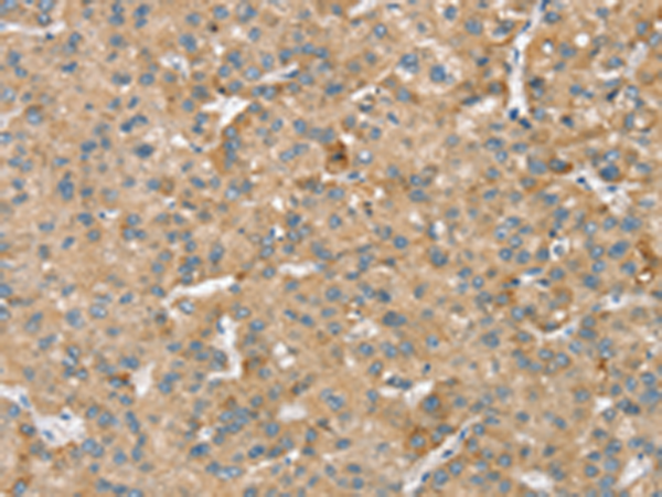 Rabbit Polyclonal Antibody to SMC4