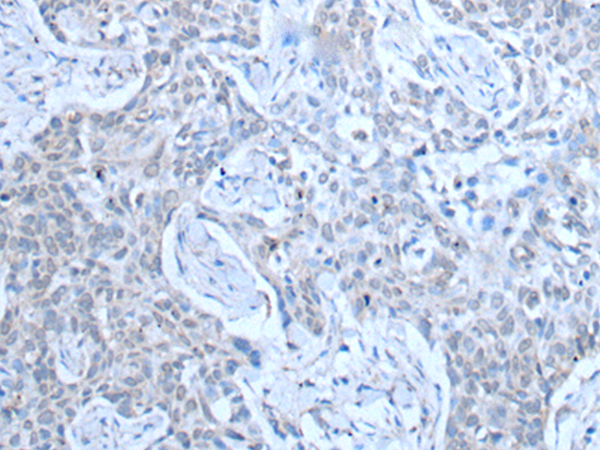 Rabbit Polyclonal Antibody to SMC5
