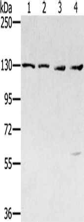 Rabbit Polyclonal Antibody to SMC6