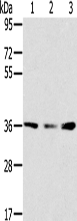 Rabbit Polyclonal Antibody to SMN1