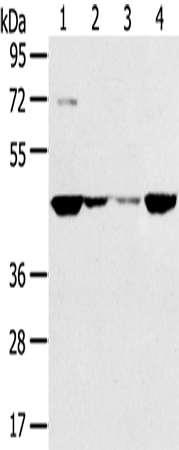 Rabbit Polyclonal Antibody to SMYD5
