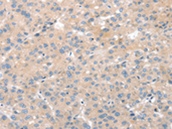 Rabbit Polyclonal Antibody to SNX29