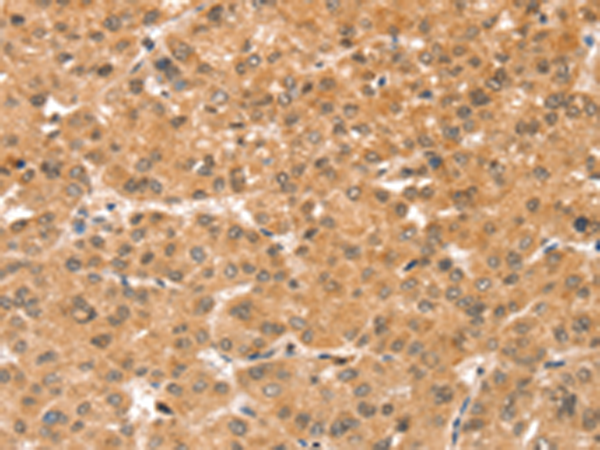 Rabbit Polyclonal Antibody to SNX30