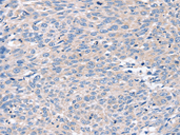 Rabbit Polyclonal Antibody to ROR1