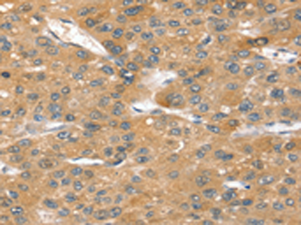 Rabbit Polyclonal Antibody to SORT1