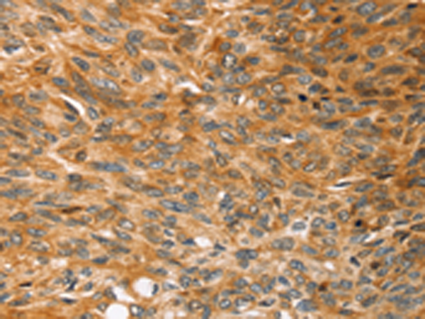Rabbit Polyclonal Antibody to SOX11