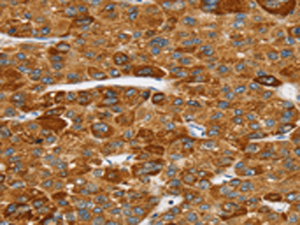 Rabbit Polyclonal Antibody to SPARCL1