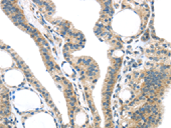 Rabbit Polyclonal Antibody to SPDL1