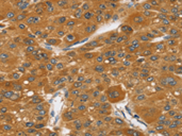 Rabbit Polyclonal Antibody to SRGAP1