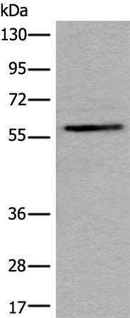 Rabbit Polyclonal Antibody to STS