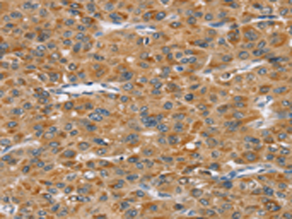 Rabbit Polyclonal Antibody to STAB1