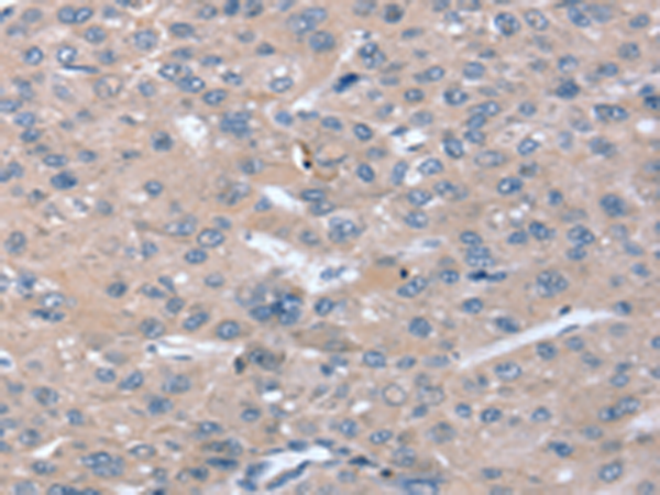 Rabbit Polyclonal Antibody to STK36
