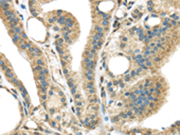 Rabbit Polyclonal Antibody to STK35